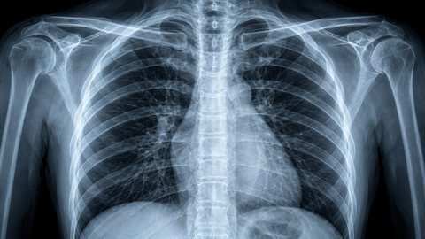 X-Ray Vision: See-through radiograph with glowing bones on black.